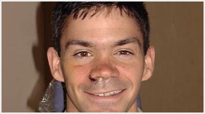 Американський сержант вижив після  пострілу у обличчя.