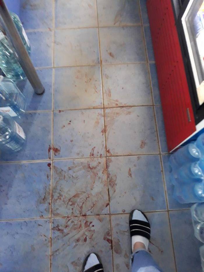 В магазині після нападу знайшли гільзу, коли відмивали кров 