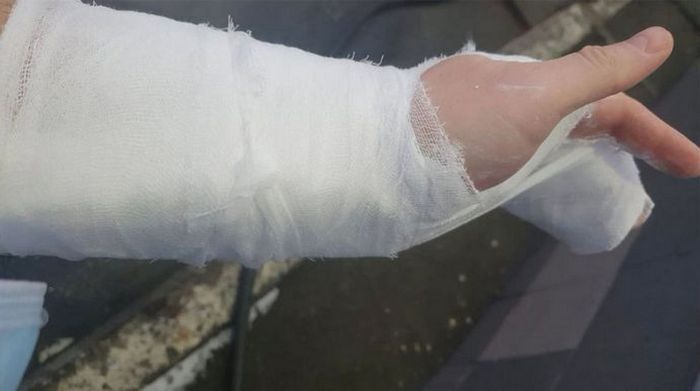 Неадекватний охоронець київської лікарні зламав руку відвідувачу