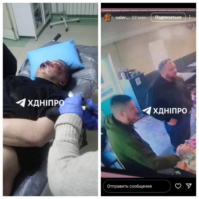 Побитий хлопець та підозрювані